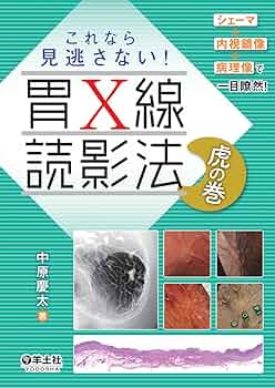 消化管X線読影講座　1-1　胃間接X線写真読影 81CI6a5NRRL._AC_UL210_SR210,